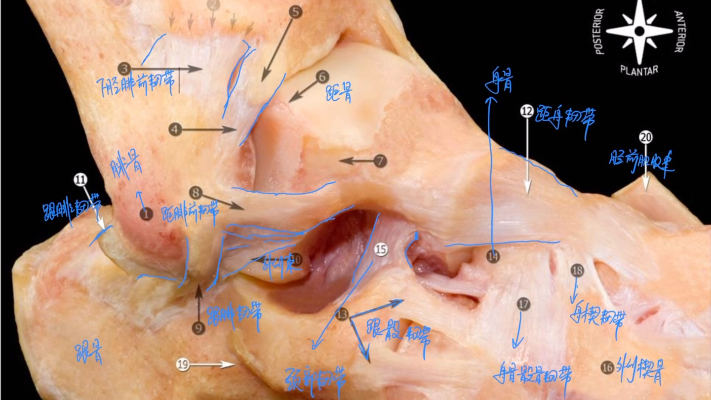 [图]高清踝关节，足部韧带实体解剖，改变你对解剖的认知(珍稀资源)