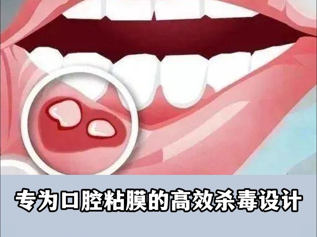 口腔溃疡小科普,碰上它就能缓解哔哩哔哩bilibili