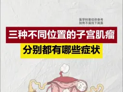 Download Video: 三种不同位置的子宫肌瘤，分别都有哪些症状