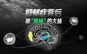 Video herunterladen: 李玟因抑郁症去世：我国每14人就有1例 抑郁症如何“毁掉”大脑？