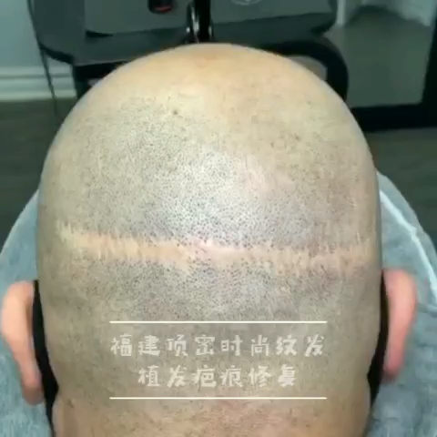 温暖这个冬天##纹发##福建顶密时尚纹