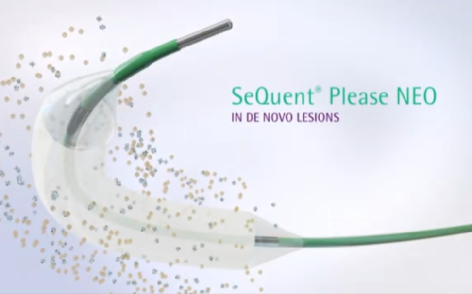 【转载】医疗器械贝朗Sequent Please Neo药物球囊哔哩哔哩bilibili