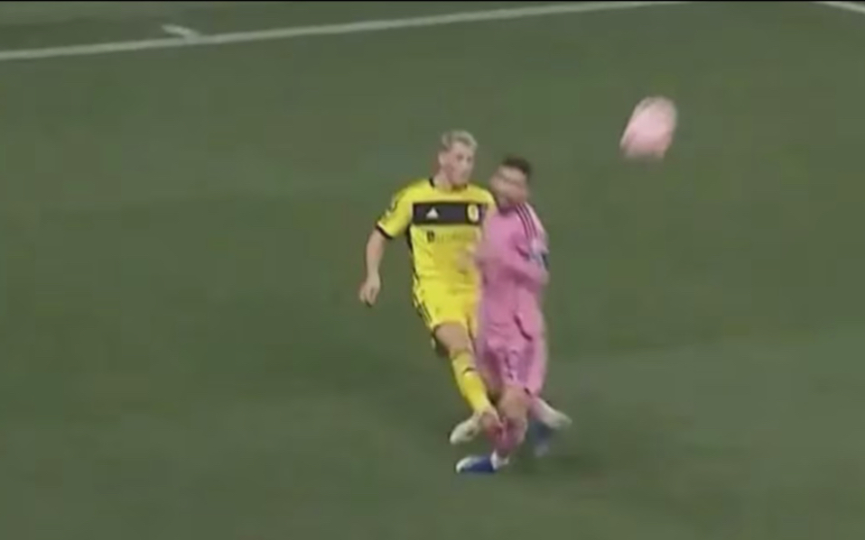 梅西的腿几乎被铲断,目前仍有痊愈风险