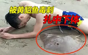 Download Video: 最出人意料的7种海洋动物袭击，小伙被黄貂鱼攻击下体