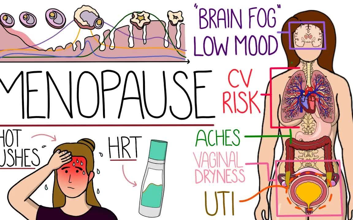 【中英文字幕】更年期解释清楚(包括 HRT 和围绝经期)哔哩哔哩bilibili