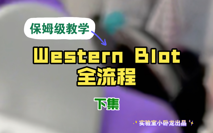 【干货分享 Western Blot跑胶下集】下集来啦~从敷抗体到显膜,一镜到底沉浸式体验哔哩哔哩bilibili