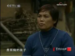 Télécharger la video: 《走近科学》20090202 半脑人