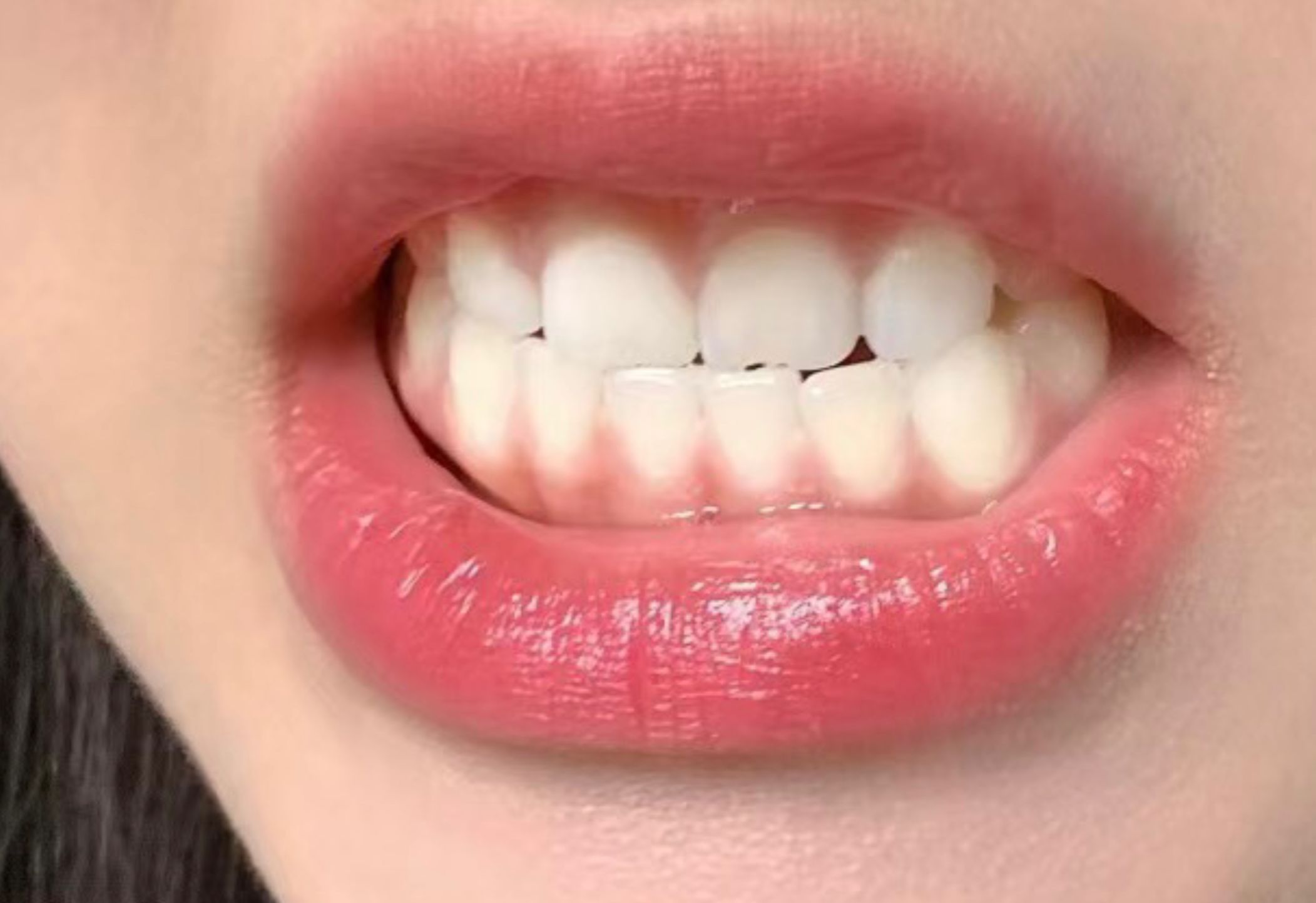 网上传疯了的白牙技巧