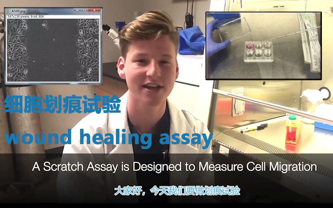 【中字基础科研学习】细胞划痕试验wound healing assay,外国实验室教你做细胞划痕试验哔哩哔哩bilibili