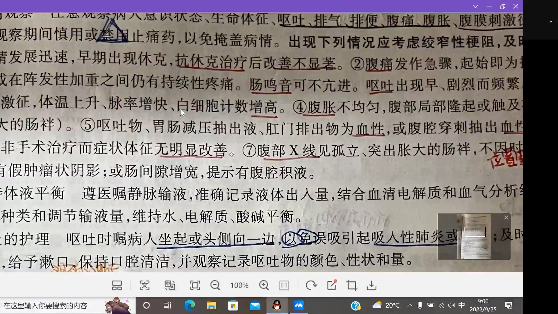 [图]外科护理学（肠梗阻病人的护理）