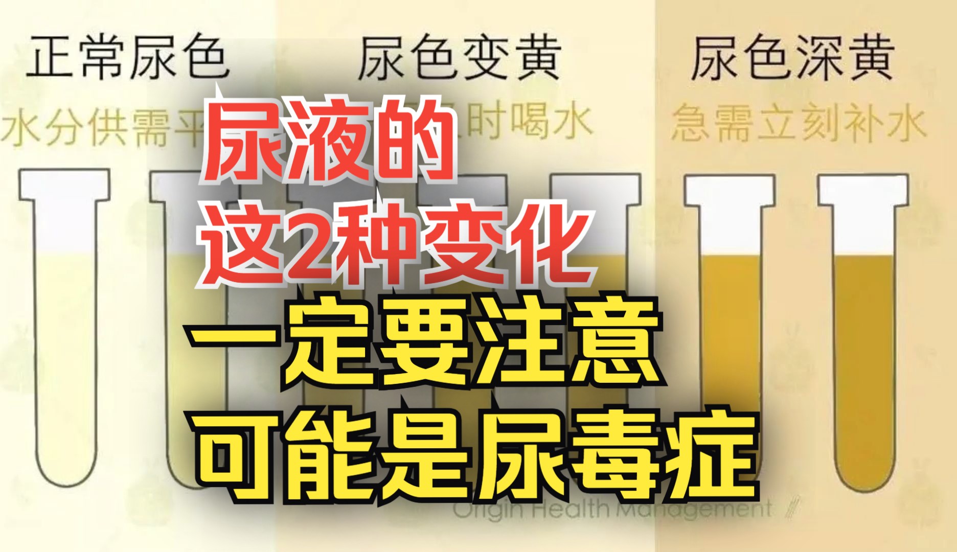 尿液出现这2个现象、请尽快就医、千万不要把自己拖成了尿毒症哔哩哔哩bilibili