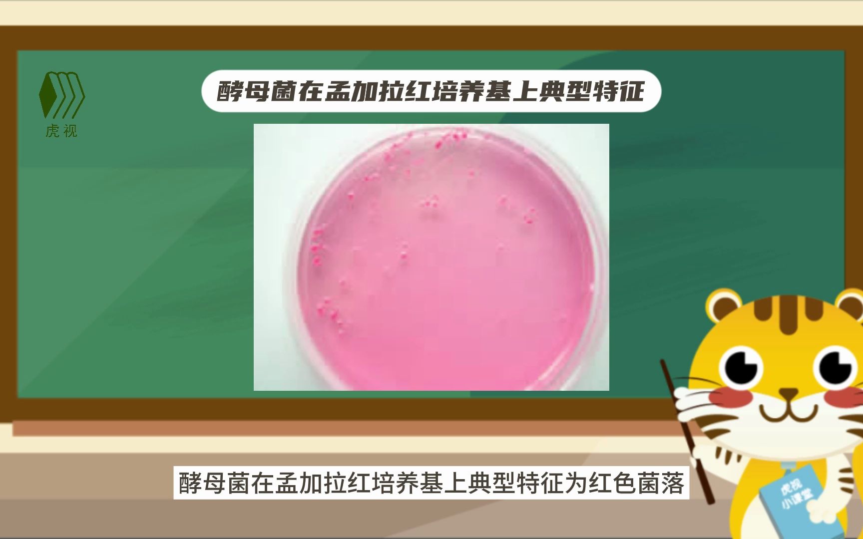 各细菌菌落特征(上)哔哩哔哩bilibili