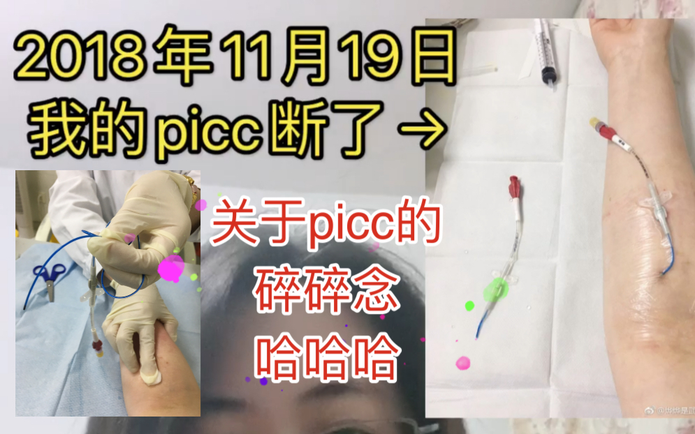 【治疗 13】化疗前picc置管疼不疼?为啥我的picc断了...有picc怎么洗澡?哔哩哔哩bilibili