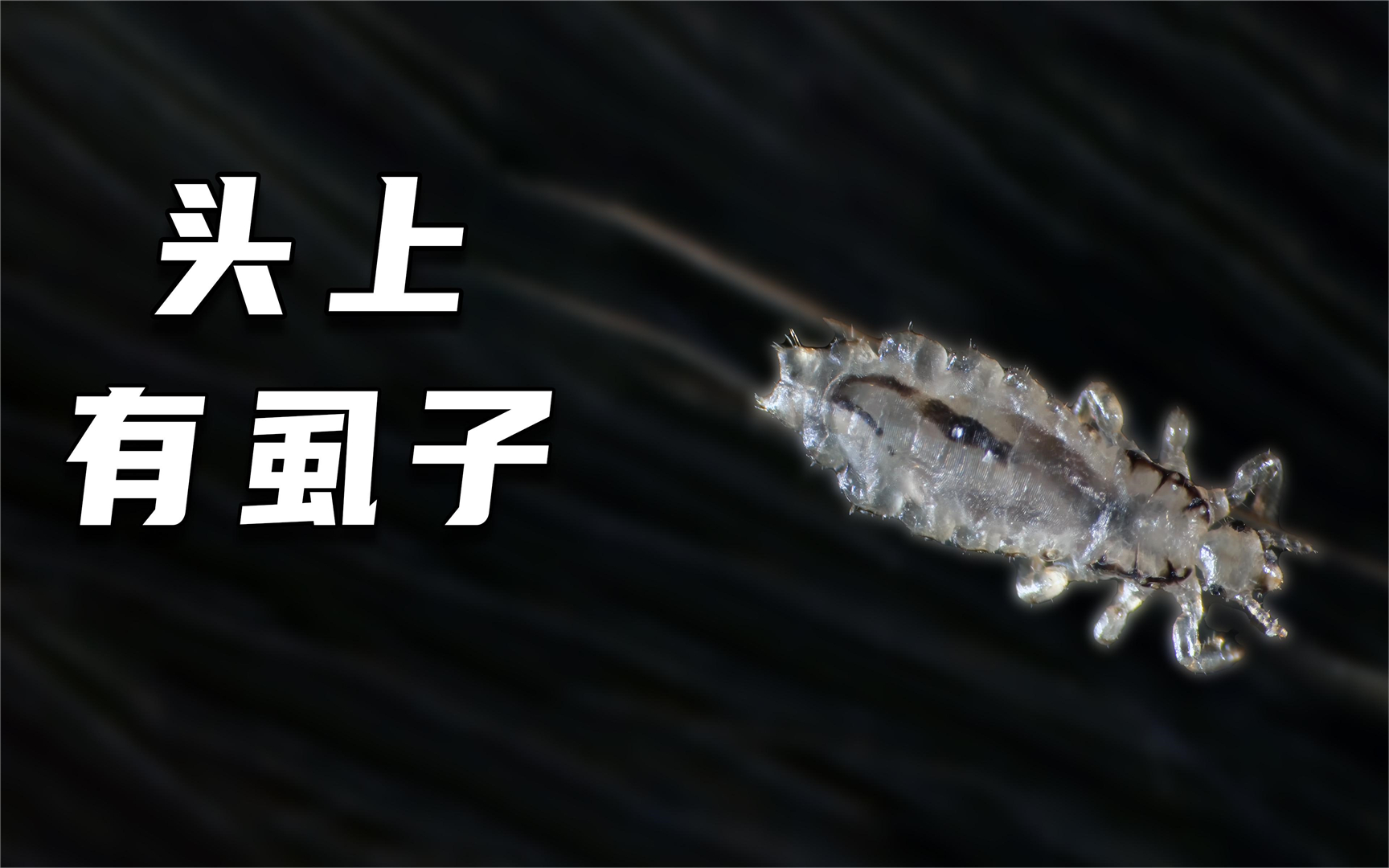 外国人的头上长虱子