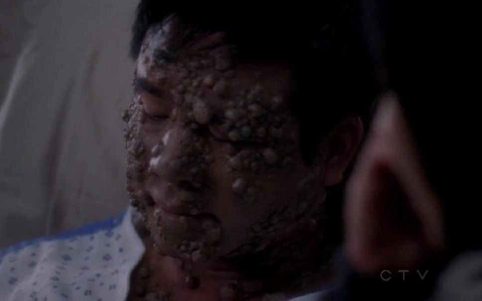 活动作品如果男性感染了hpv