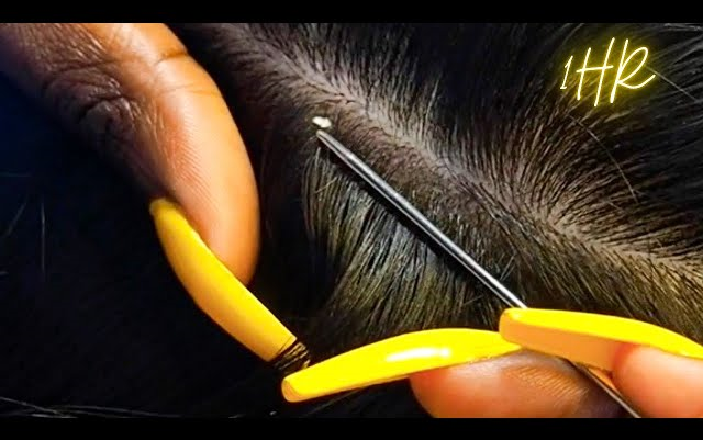 1 HR Super Attentive NITPICKING SCALP WHITEHEADS | zoomed哔哩哔哩bilibili