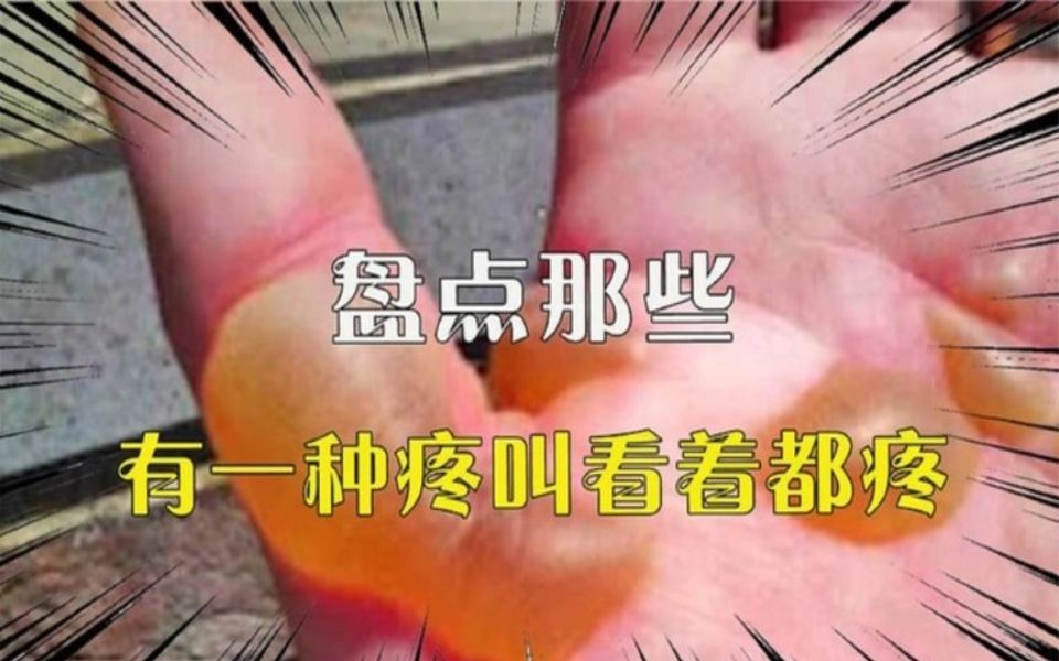 [图]盘点看着就疼的瞬间，每一个都疼的深入骨髓，隔屏幕都扎心阿