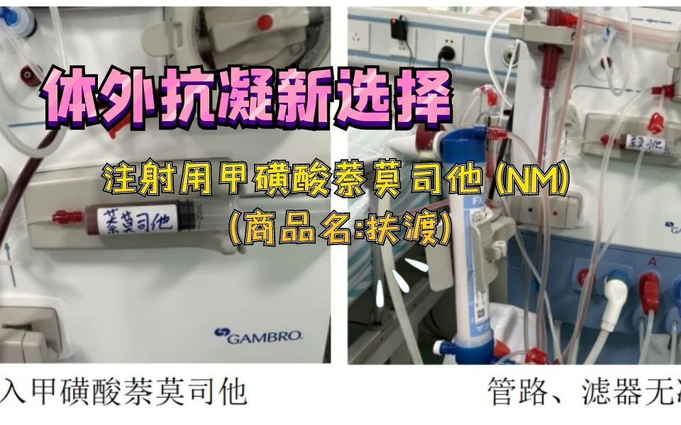 住院总D3体外抗凝新选择注射用甲磺酸萘莫司他(NM)(商品名:扶渡)哔哩哔哩bilibili