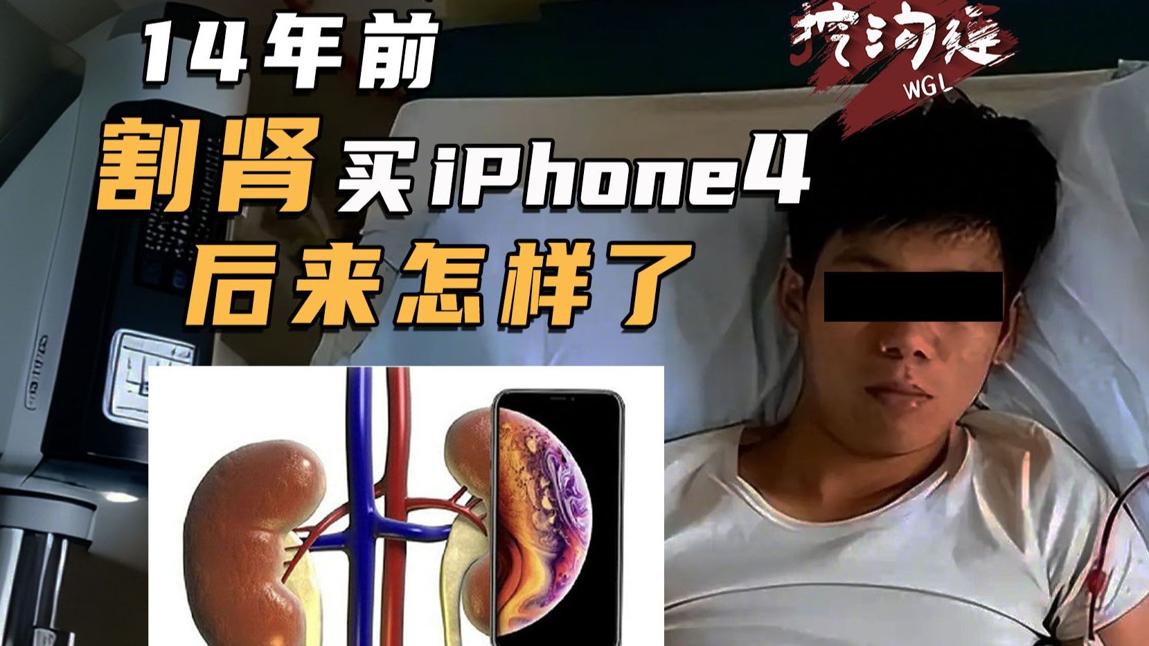 17岁男孩为买苹果手机割肾,幕后黑手竟是正规医生?获赔147万却生不如死