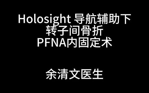 导航辅助下转子间骨折PFNA内固定术哔哩哔哩bilibili