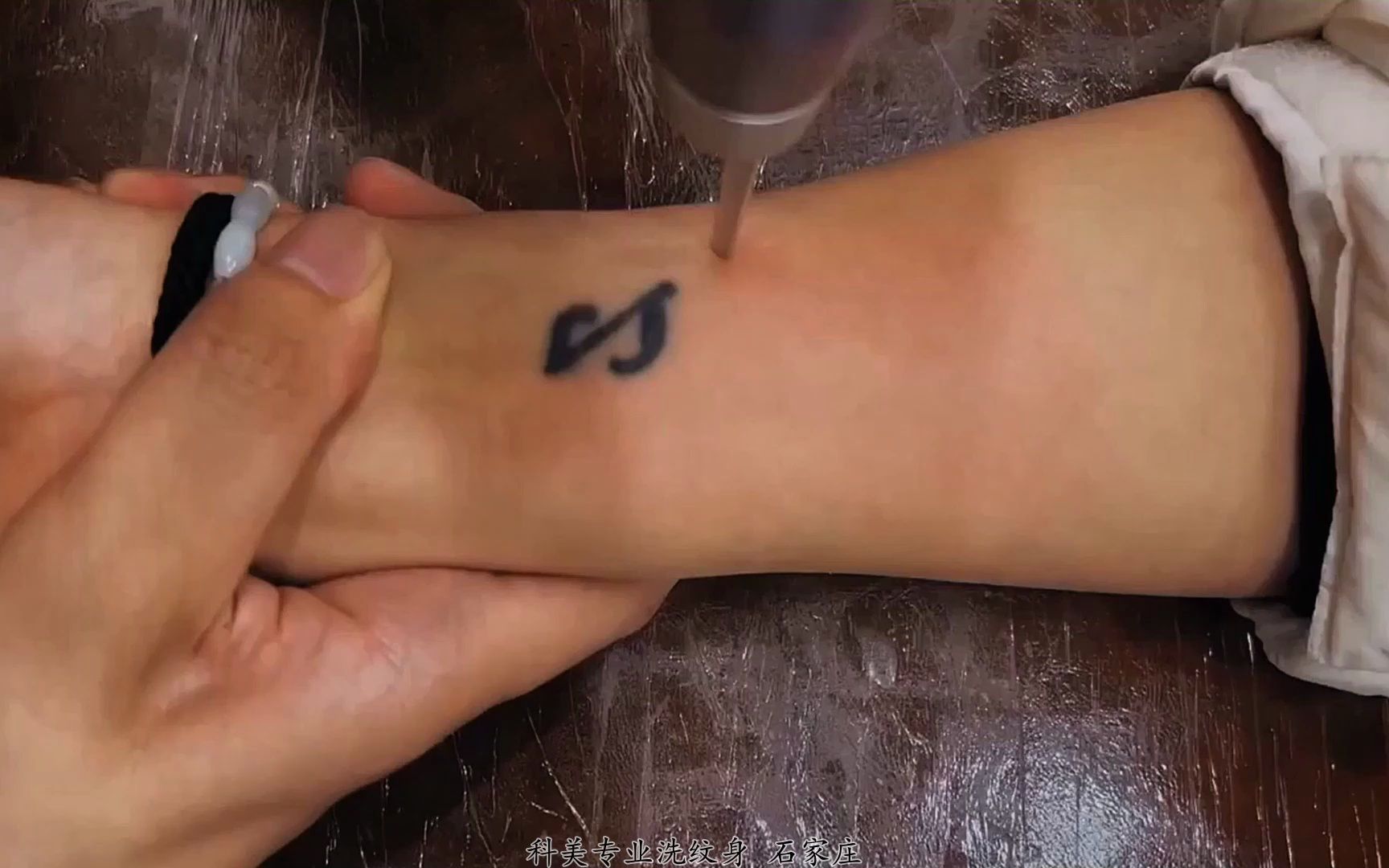 科美专洗难洗别人洗不掉的纹身,不留疤不增生 #石家庄洗纹身 #超皮秒
