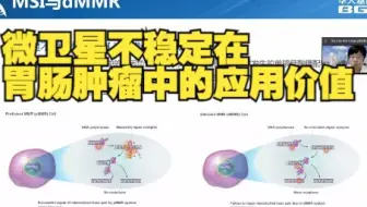 宗亮：微卫星不稳定在胃肠肿瘤中的应用价值