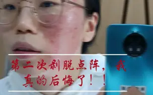 Video herunterladen: 千万不要做点阵激光，听我的没错！