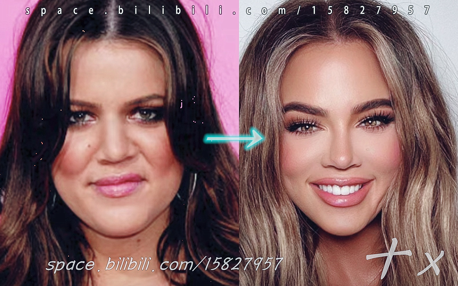 《卡戴珊家族Khloe整容史》 Kardashian: Plastic Surgery (2020) | 高清剪辑.十x哔哩哔哩bilibili