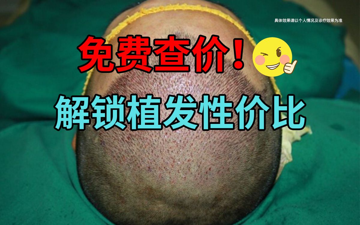 植发技术革新:让你的头发 “原地复活” 不是梦!哔哩哔哩bilibili