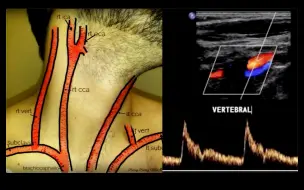 Download Video: 12分钟学习颈动脉超声