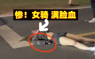 Download Video: 好惨！女骑妹子玩飙车， 结果发生车祸！满脸是血，太可怕了！【267期】