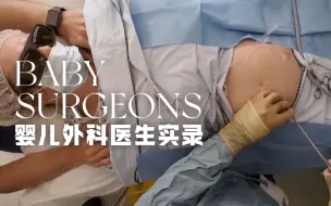 Скачать видео: 【婴儿外科医生实录】看点2-4 激光阻断血管拯救双胞胎