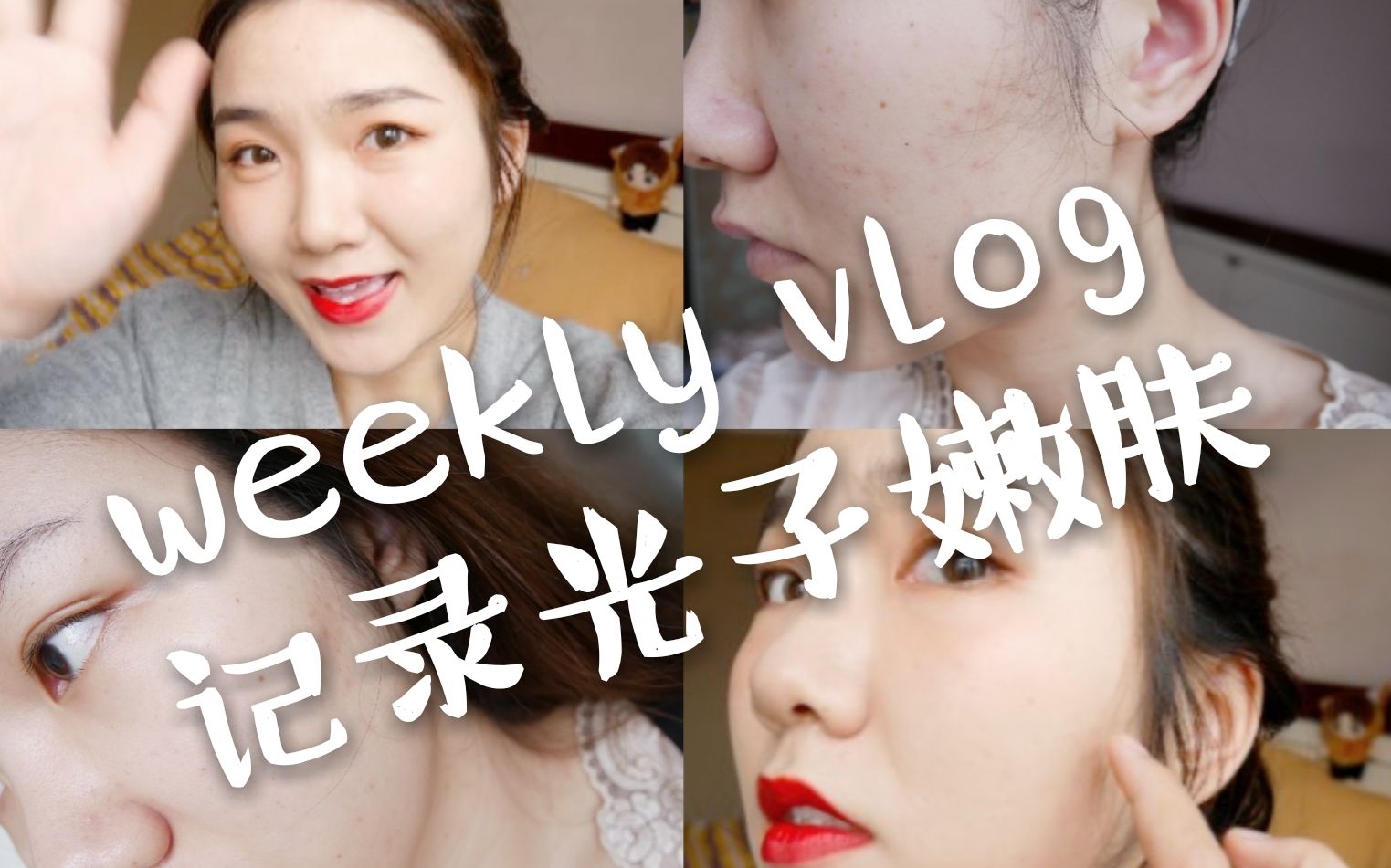 Vlog/聊聊第一次做光子嫩肤的感觉/IPL后期恢复/每天敷医美面膜?哔哩哔哩bilibili