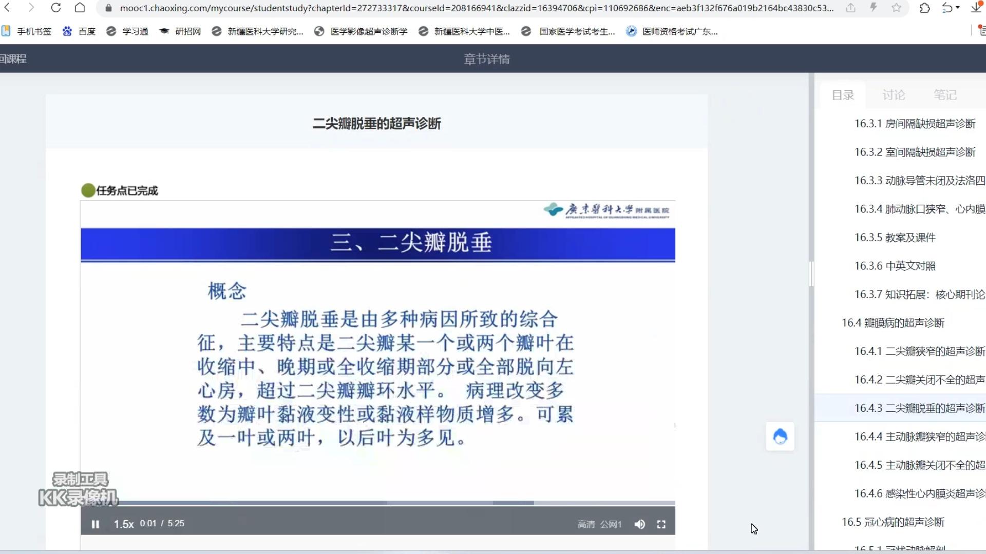 二尖瓣脱垂-超声心动图