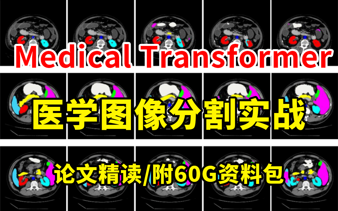 【B站强推】基于MedicalTransformer的医学图像分割实战!论文解读+代码实现!哔哩哔哩bilibili