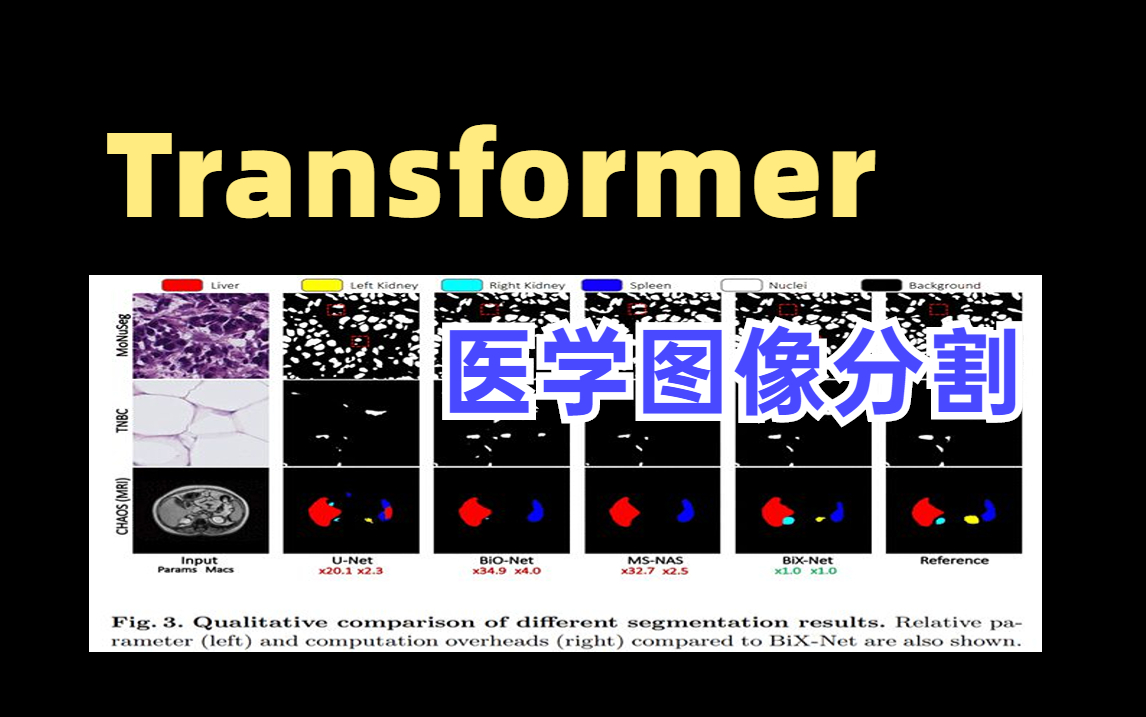 Transformer跨界做医学图像分割 !从未见过如此通俗易懂的深度学习实战教程,论文精读+代码复现,讲得太透彻了!!注意力机制|图像分割|深度学习|人工...