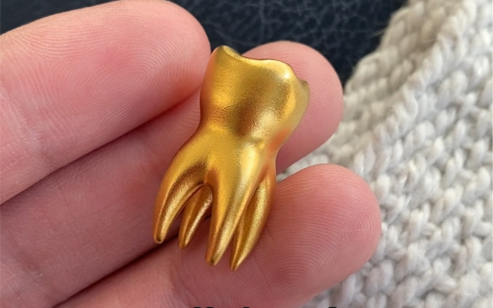 年纪轻轻就戴上了大金牙