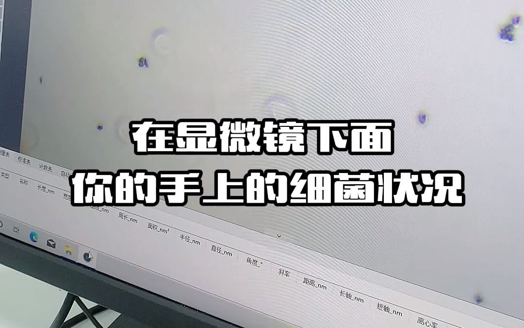 [图]如果不洗手会怎样？显微镜下的手手到底有多脏！