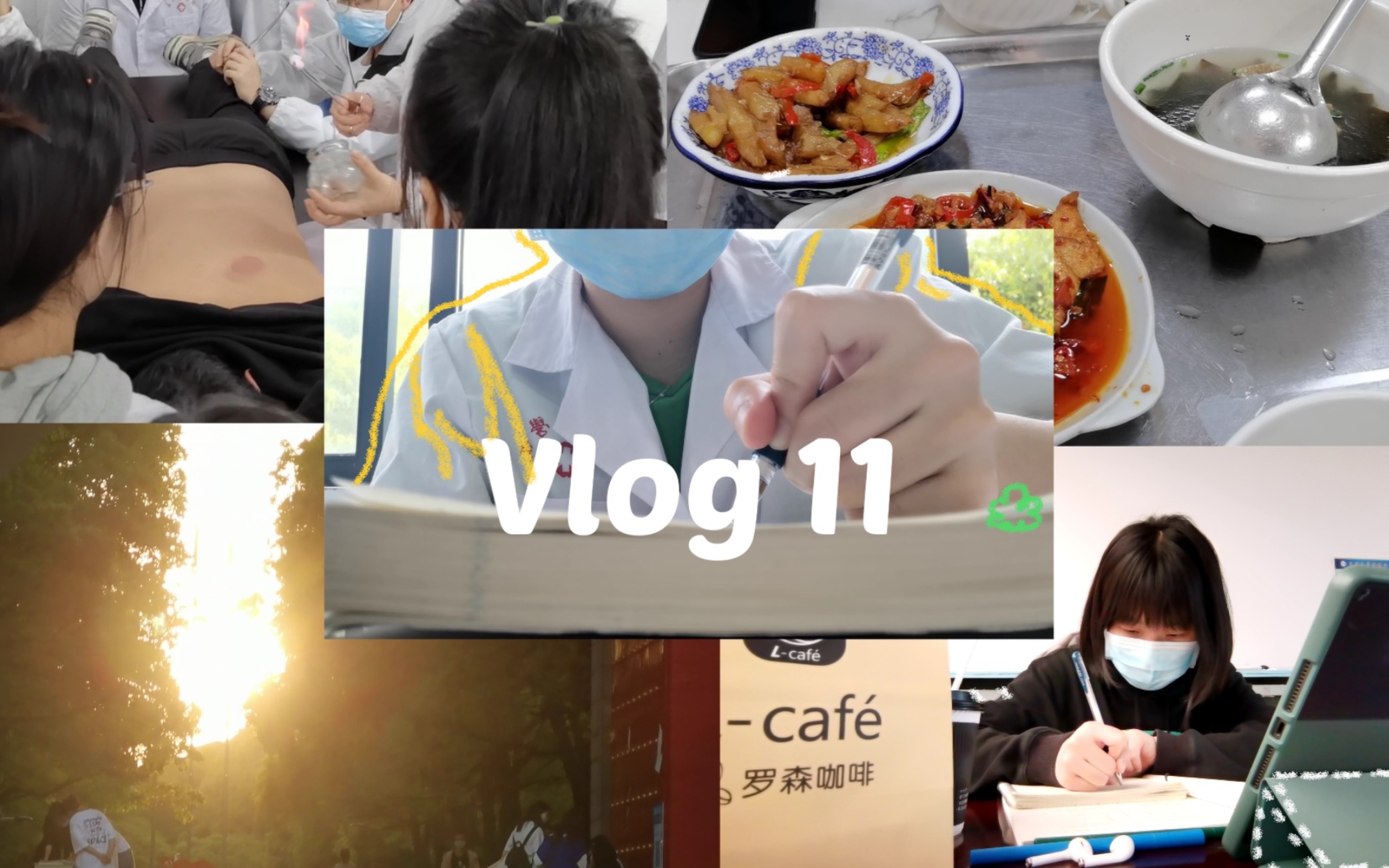 [图]【医学生vlog】针灸推拿学｜study with me｜温针灸｜拔罐 闪罐 走罐｜练功法「易筋经」｜夏天到了｜上课