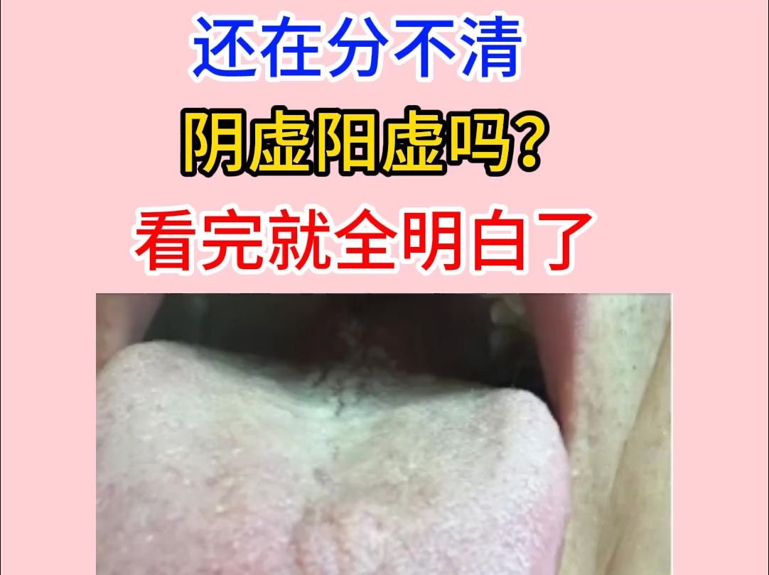 不够硬是阴虚还是阳虚(飞机打多了属于肾阴虚还是阳虚)