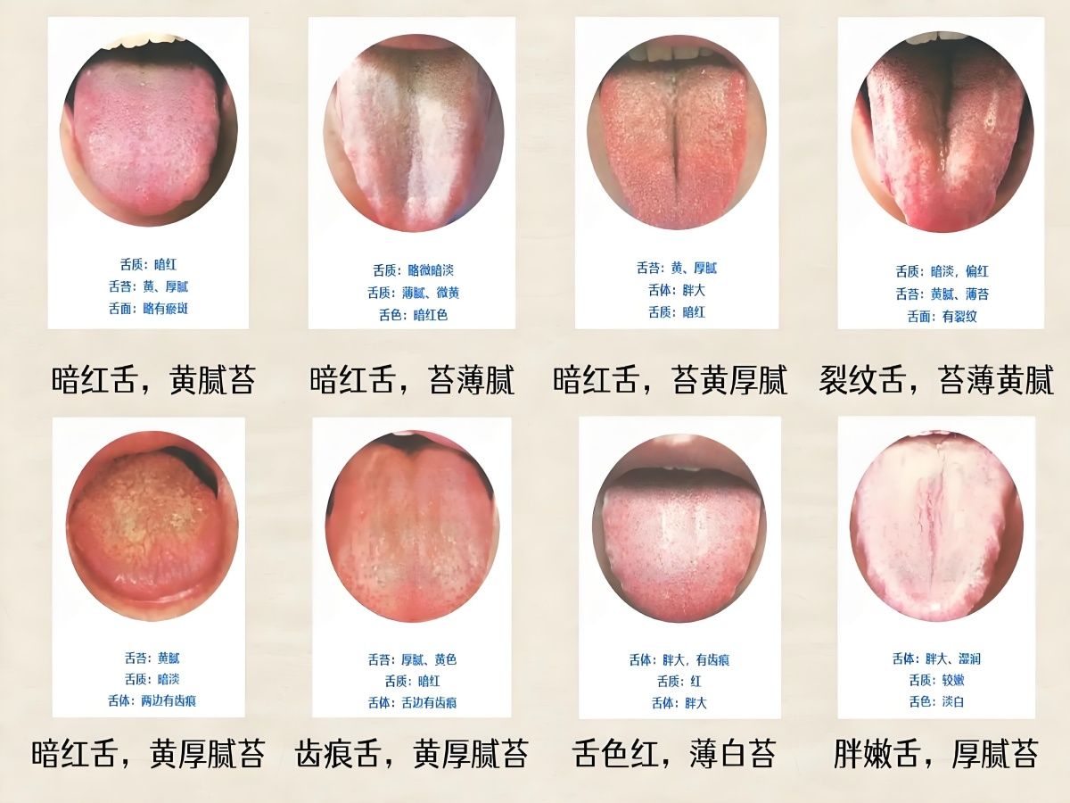 中医舌诊教学哔哩哔哩bilibili