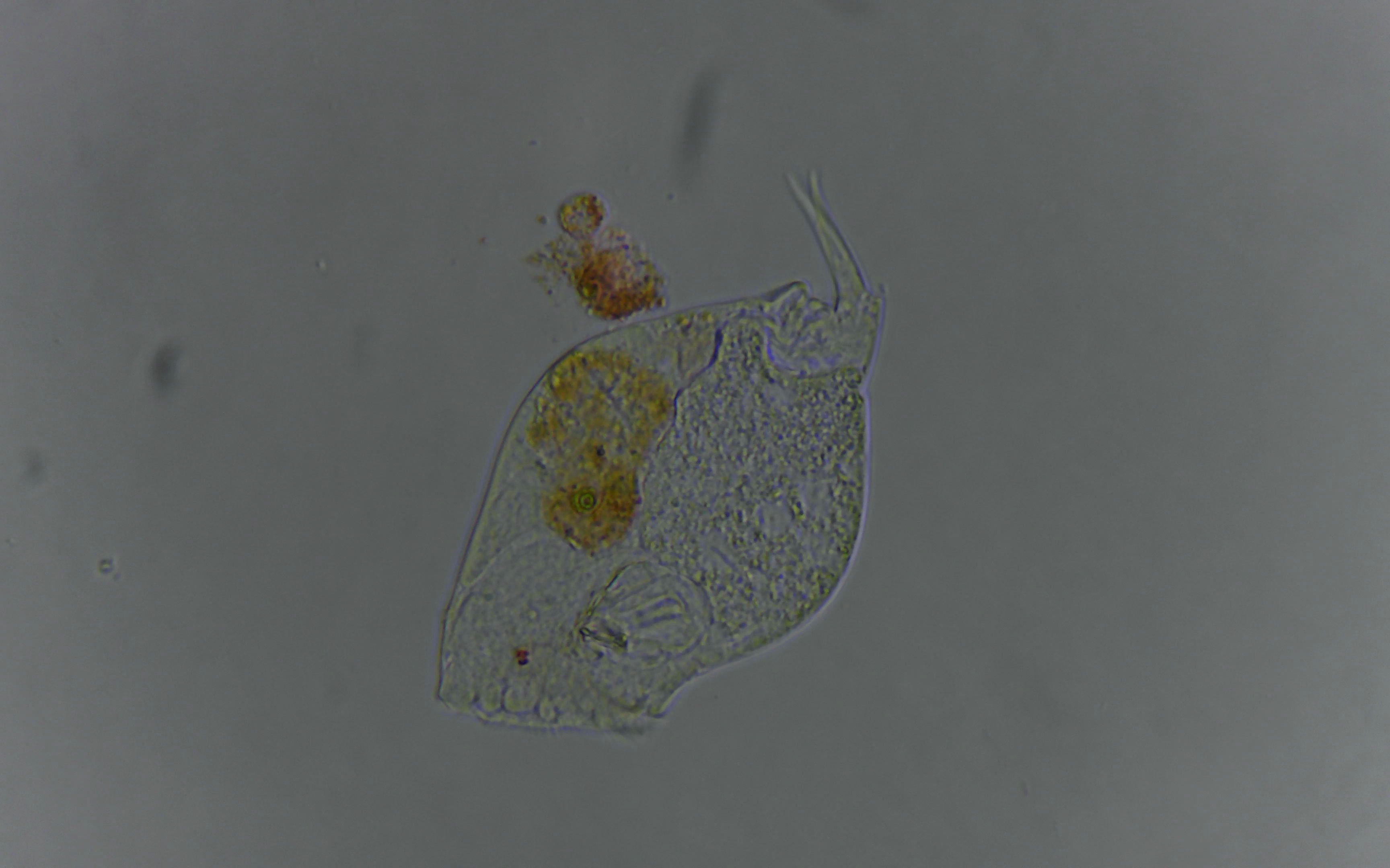 显微镜斜射暗场照明排泄拉粑粑的轮虫
