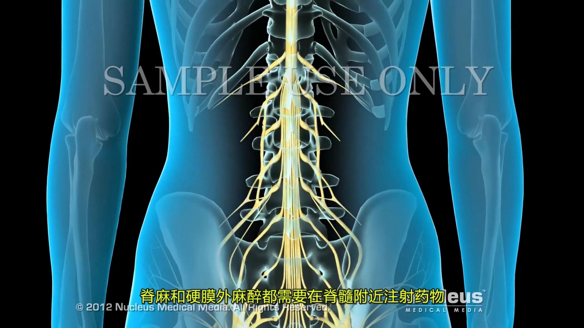 【3D医学动画】腰麻(脊髓和硬膜外麻醉)哔哩哔哩bilibili