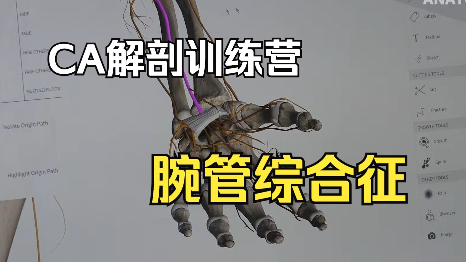 【硬核干货】从解剖学角度看腕管综合征 Carpal Tunnel Syndrome Anatomy Slices哔哩哔哩bilibili