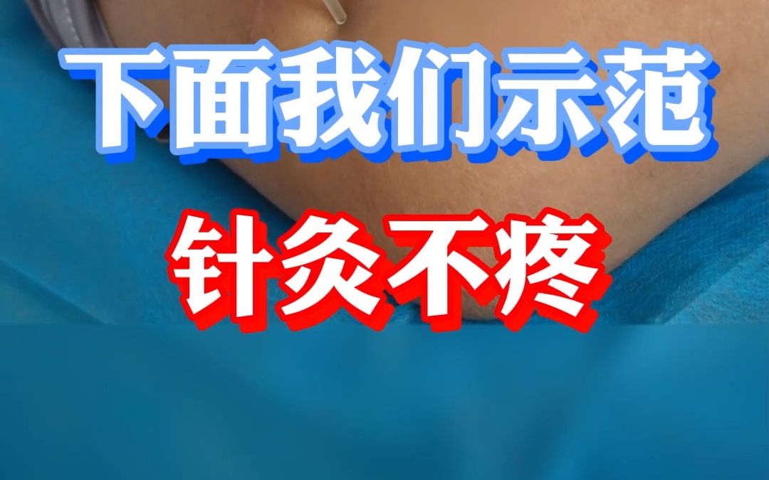 中医针灸无痛进针法哔哩哔哩bilibili