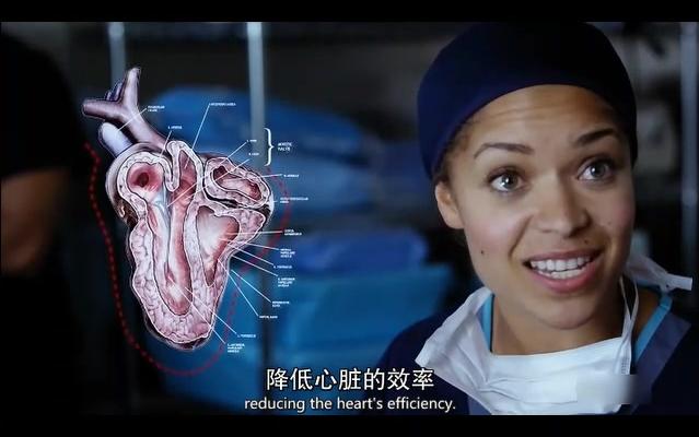 [图]看医疗剧学医学英语丨The good doctor S01E01丨第05期