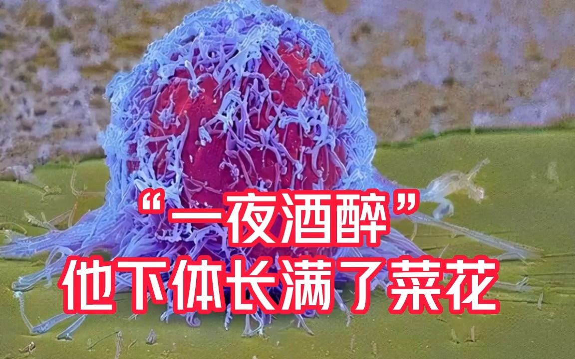 [图]“一夜酒醉”，他下体长满了菜花