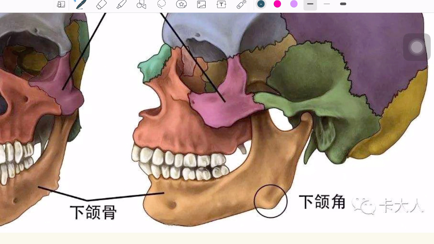 【口外】下颌骨骨折_哔哩哔哩_bilibili