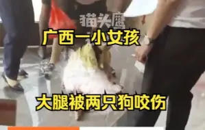 Télécharger la video: 广西一女孩身体多处被两只狗咬伤，附近市民将其抱入门内救助