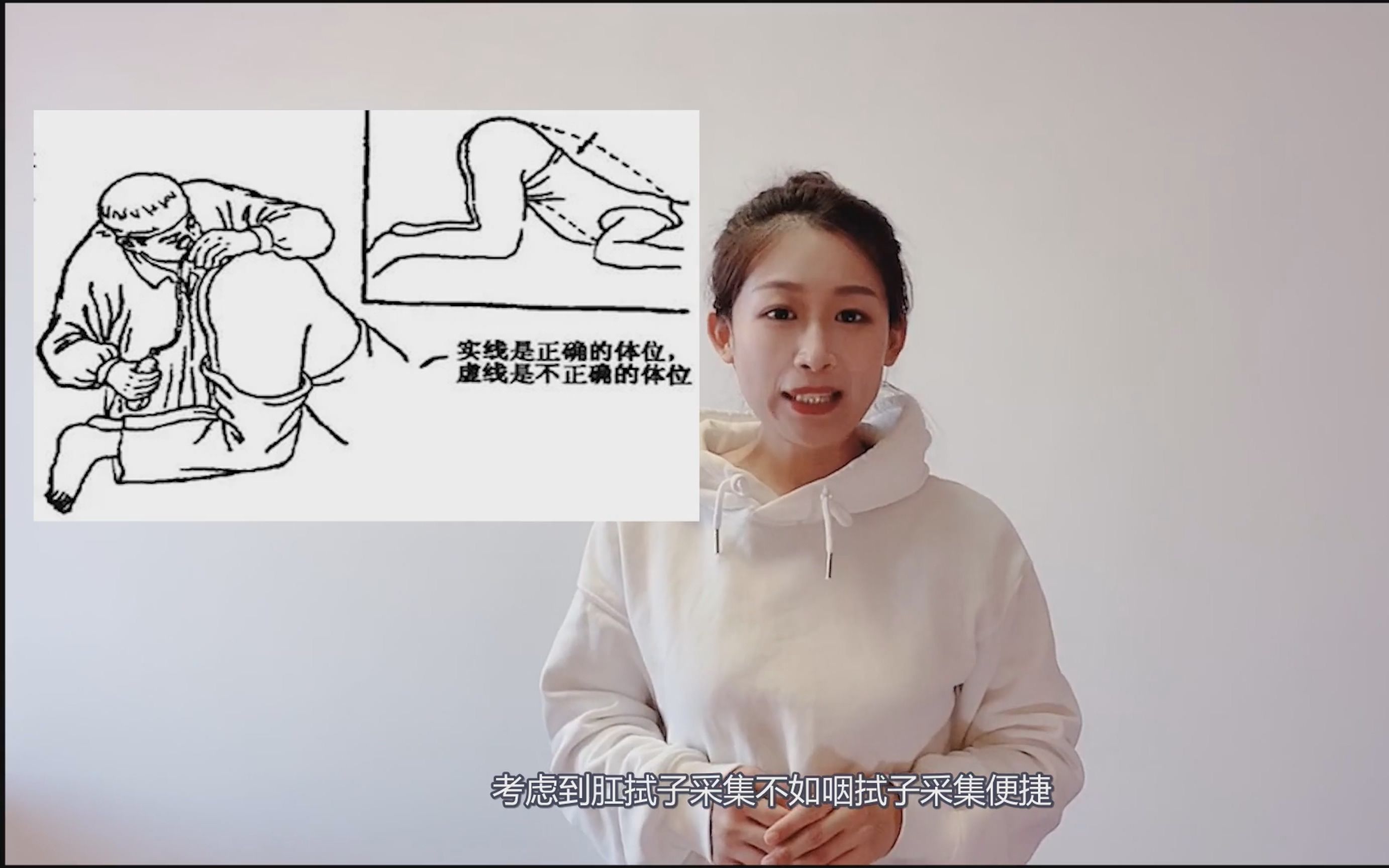 核酸检测为什么增加了肛拭子?